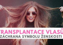 transplantace vlasů