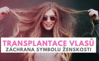 transplantace vlasů
